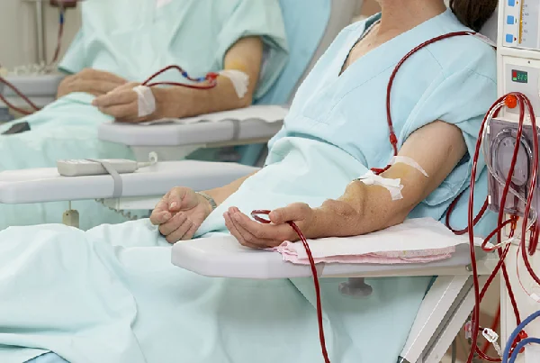 AV Fistula Permcath and AV Graft for Dialysis