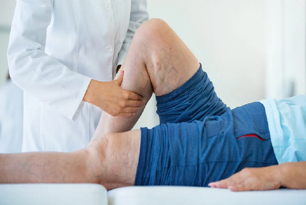 Thrombosis Treatment